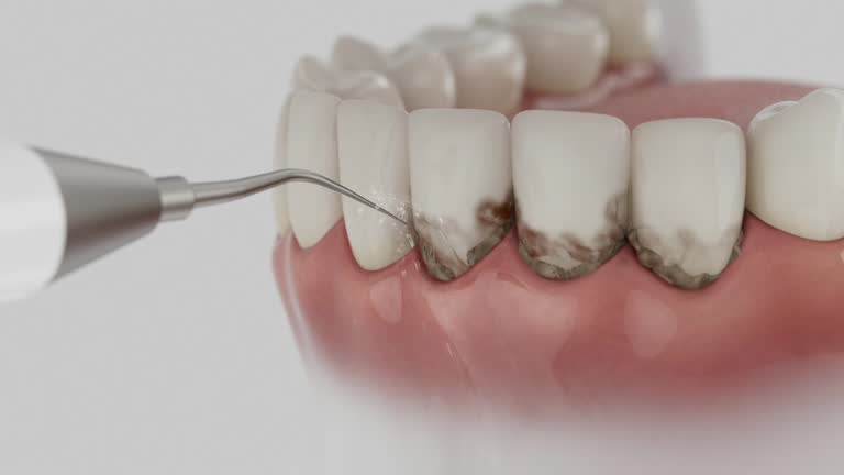 Reliable Dental Implants contractor in Jonesville, NC by Smile Center Dentistry